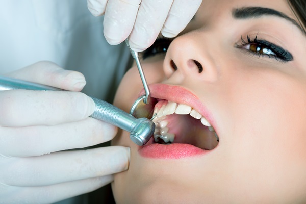 Ways To Avoid Getting A Dental Filling